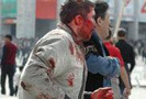 Волнения в Бишкеке унесли уже 79 жизней